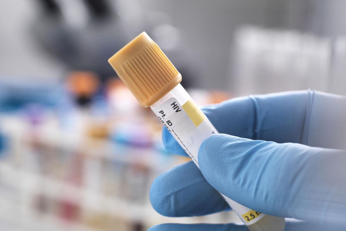 Lab technician holding an HIV test tube